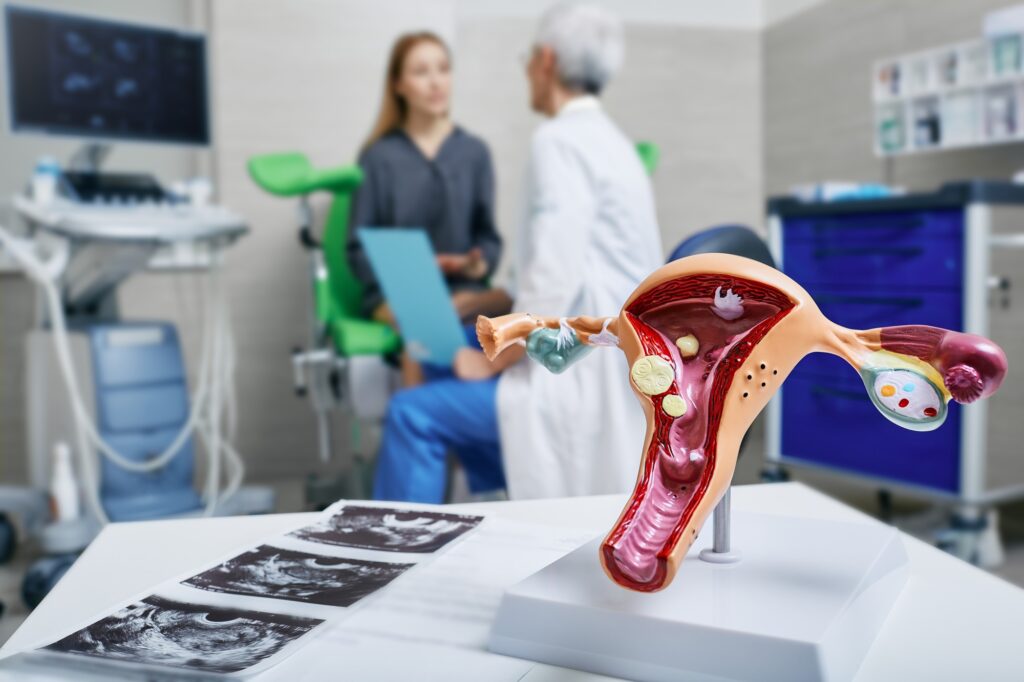 a model of uterus on a table